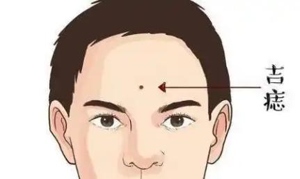男人臉上哪里長痣最有福氣？